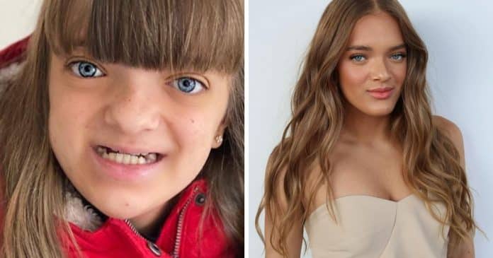 a-surpreendente-jornada-de-rafaella-justus-da-malformacao-a-transformacao-inspiradora-na-adolescencia A surpreendente jornada de Rafaella Justus: da malformação à transformação inspiradora na adolescência