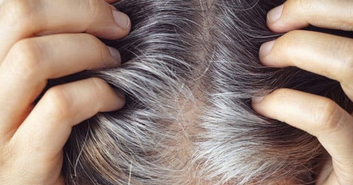 Cabelos grisalhos podem ser um mecanismo natural de proteção do corpo CONTRA o câncer, revela estudo japonês