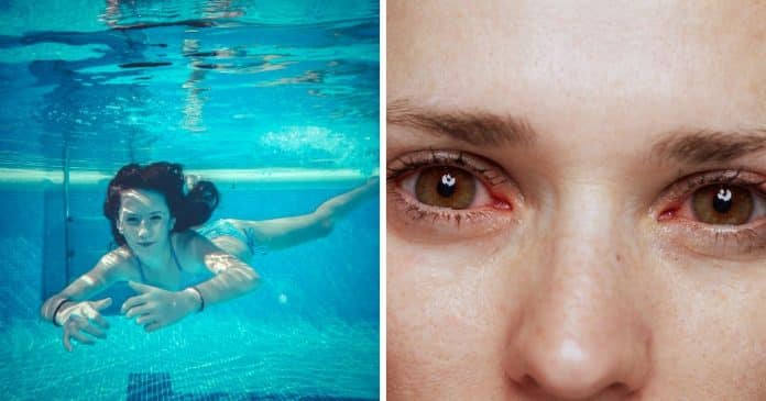 Ficar com olhos vermelhos após nadar na piscina nem sempre é culpa do cloro — e o que está por trás vai chocar você