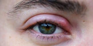 A causa para seu TERÇOL pode ser algo muito mais profundo que “seus olhos querem te dizer”