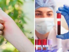 Ciência revela que seu tipo de sangue pode ser o verdadeiro “imã de mosquitos” – por isso você é mais picado que outros