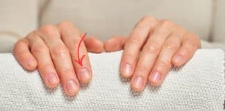 OLHE PARA A SUA UNHA AGORA: Se a ‘meia-lua’ sumiu, seu corpo pode estar pedindo socorro