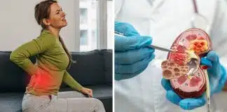 Por que uma “pedrinha” no rim dói mais que um parto? A chocante resposta microscópica explica tudo