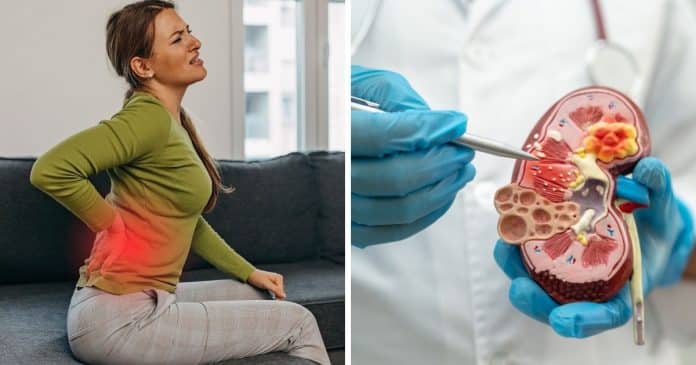 Por que uma “pedrinha” no rim dói mais que um parto? A chocante resposta microscópica explica tudo