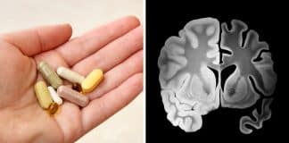 4 combinações perigosas de suplementos que prejudicam o cérebro — e acelerar o envelhecimento mental sem você perceber