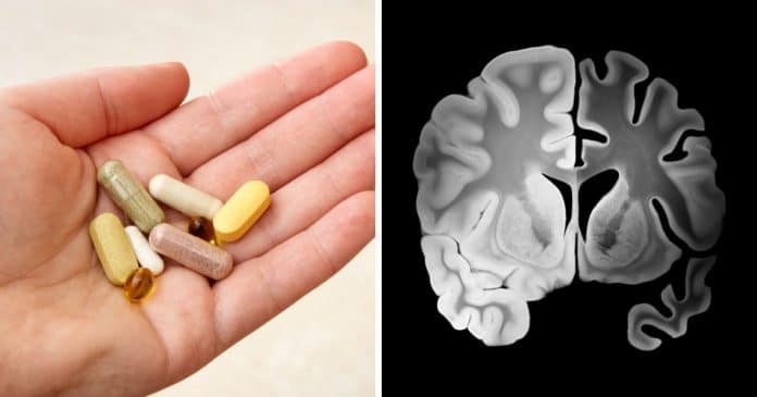4 combinações perigosas de suplementos que prejudicam o cérebro — e acelerar o envelhecimento mental sem você perceber