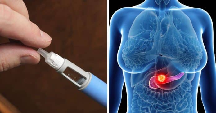 Anvisa gera alerta ao registrar 06 mortes e 145 casos de pancreatite associadas ao uso de canetas emagrecedoras