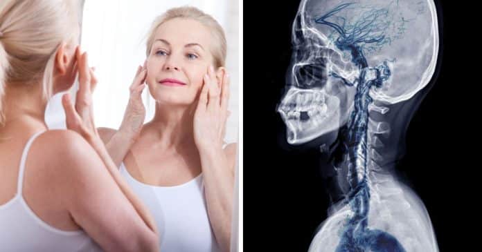 Estudos sugerem que massagem linfática no rosto pode ajudar a “limpar” cérebro – incluindo proteínas associadas ao Alzheimer