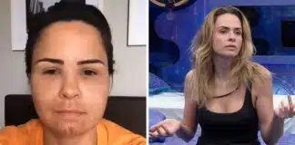 O segredo por trás da pele impecável de Ana Paula do BBB 26: Dermatologista revela tratamentos que estão dando o que falar