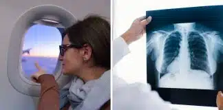“Um voo na janela equivale a 2 radiografias de tórax?”: A verdade chocante sobre voos longos, radiação e o risco real para passageiros