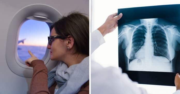 “Um voo na janela equivale a 2 radiografias de tórax?”: A verdade chocante sobre voos longos, radiação e o risco real para passageiros