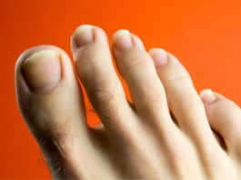 O que significa ter pelinhos crescendo nos dedos dos pés – e quando é sinal de atenção