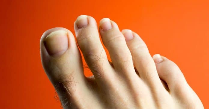 o-que-significa-ter-pelinhos-crescendo-nos-dedos-dos-pes-e-quando-e-sinal-de-atencao O que significa ter pelinhos crescendo nos dedos dos pés – e quando é sinal de atenção