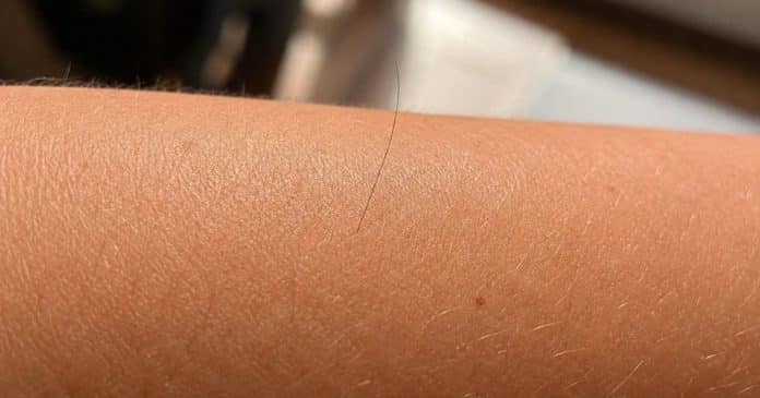 por-que-aparece-um-unico-pelo-longo-do-nada-no-corpo Por que aparece um ‘único pelo longo’ do nada no corpo?