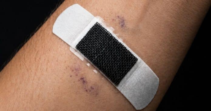 cientistas-criam-curativo-inteligente-que-elimina-97-de-celulas-cancerigenas-sem-cirurgia-em-camundongos Cientistas criam “Curativo Inteligente” que elimina 97% de células cancerígenas sem cirurgia, em camundongos
