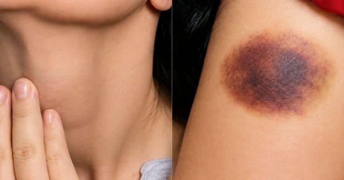 Essa doença pode dar sinais silenciosos por meses: ESTES sintomas nunca devem ser ignorados