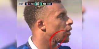Marcas no pescoço de Mbappé intriga milhões durante a Copa do Mundo 2026… e a verdade surpreendeu até torcedores