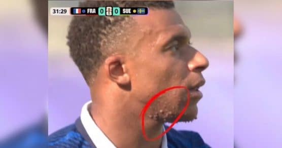 Marcas no pescoço de Mbappé intriga milhões durante a Copa do Mundo 2026… e a verdade surpreendeu até torcedores