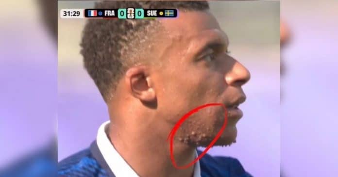 Marcas no pescoço de Mbappé intriga milhões durante a Copa do Mundo 2026… e a verdade surpreendeu até torcedores