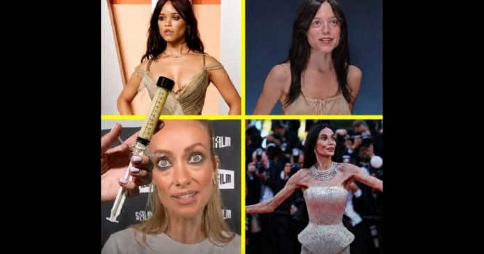 Ozempic “secou” as curvas das celebridades de Hollywood… e agora estão injetando “gordura de cadáveres” para recuperá-las