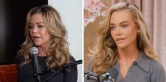 Denise Richards impressiona com antes e depois de facelift de R$1 milhão: “transplante de cabeça”