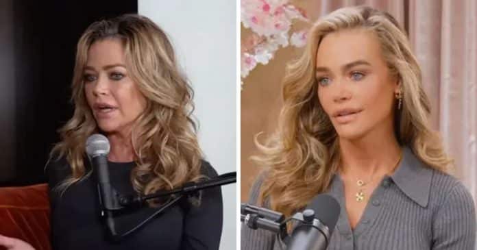 Denise Richards impressiona com antes e depois de facelift de R$1 milhão: “transplante de cabeça”