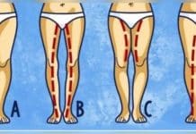 Ilustração com quatro contornos de pernas femininas, identificados pelas letras A, B, C e D.