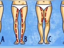 Ilustração com quatro contornos de pernas femininas, identificados pelas letras A, B, C e D.