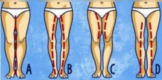 Ilustração com quatro contornos de pernas femininas, identificados pelas letras A, B, C e D.
