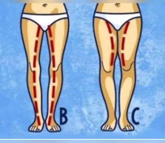 Ilustração com quatro contornos de pernas femininas, identificados pelas letras A, B, C e D.