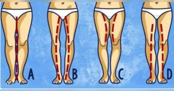 Espaço entre as coxas: diferentes contornos das pernas Suas coxas se encostam? Entenda o que isso realmente diz sobre seu corpo