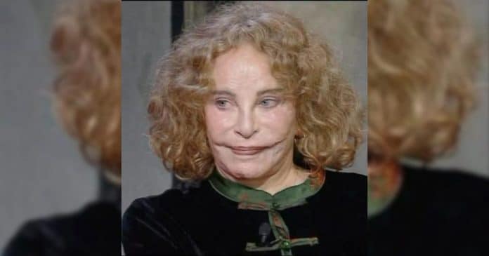 Nos anos 70, ela foi considerada “a mulher mais bonita do mundo”, mas um trágico acidente mudou seu rosto para sempre